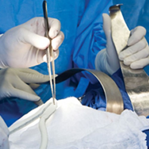 Breast surgery 2